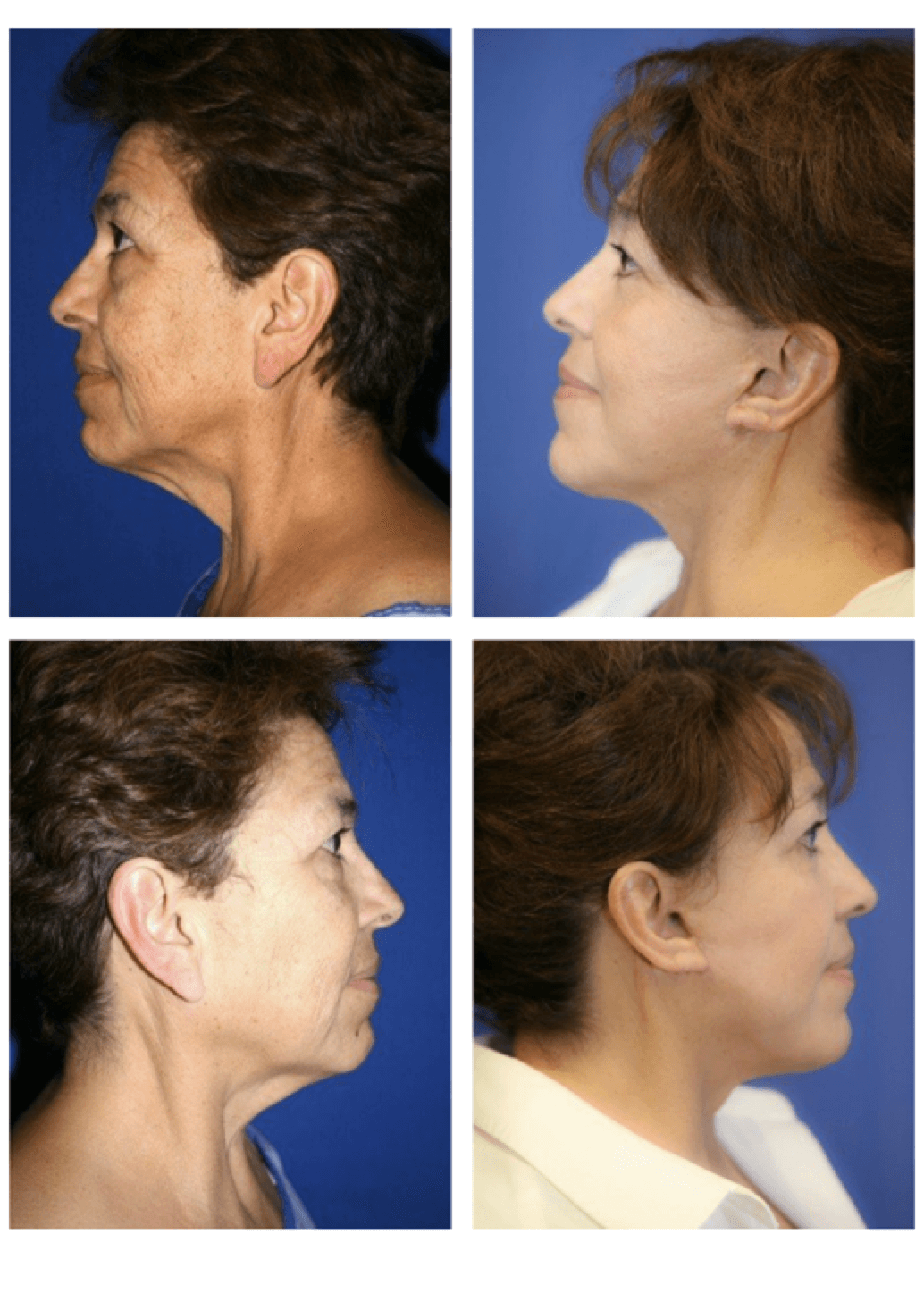 face before and after